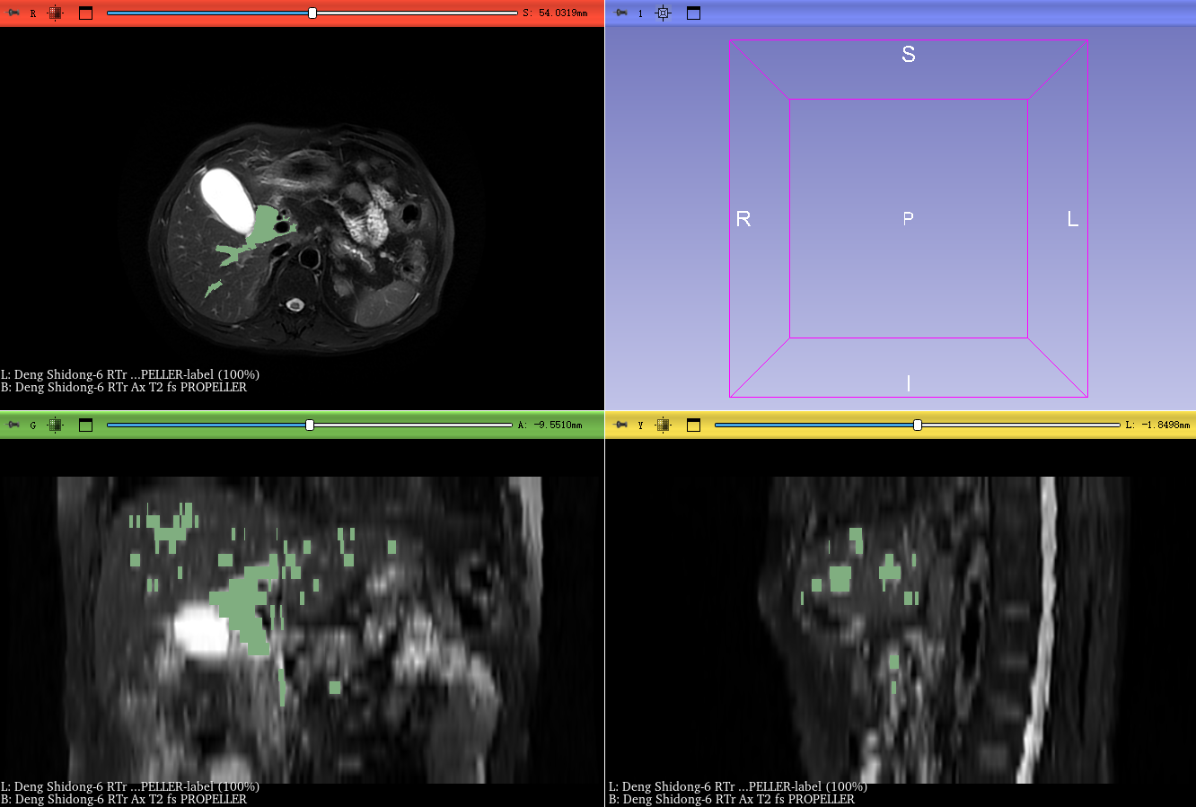 image-20260122171828066