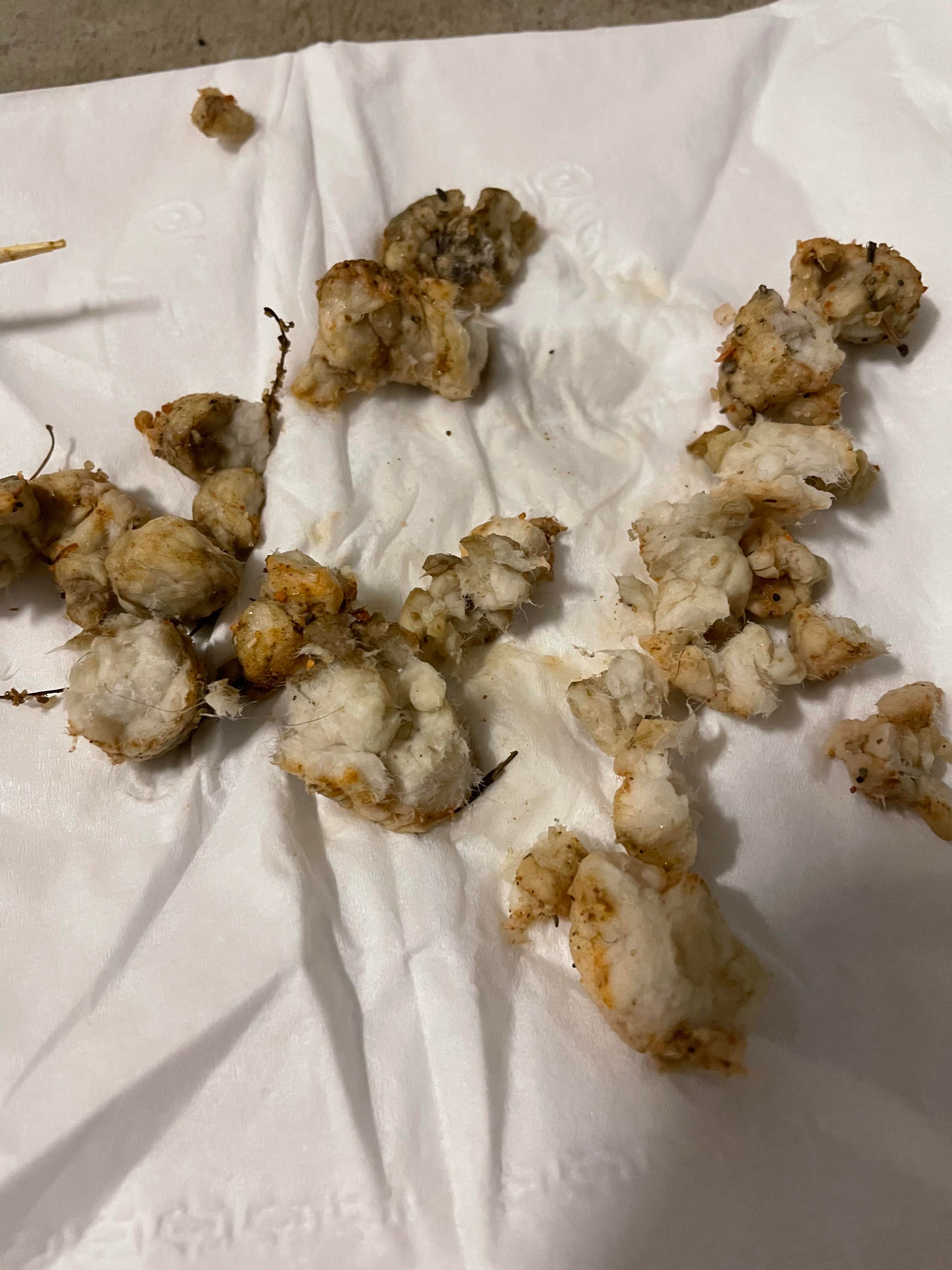白色的大脑