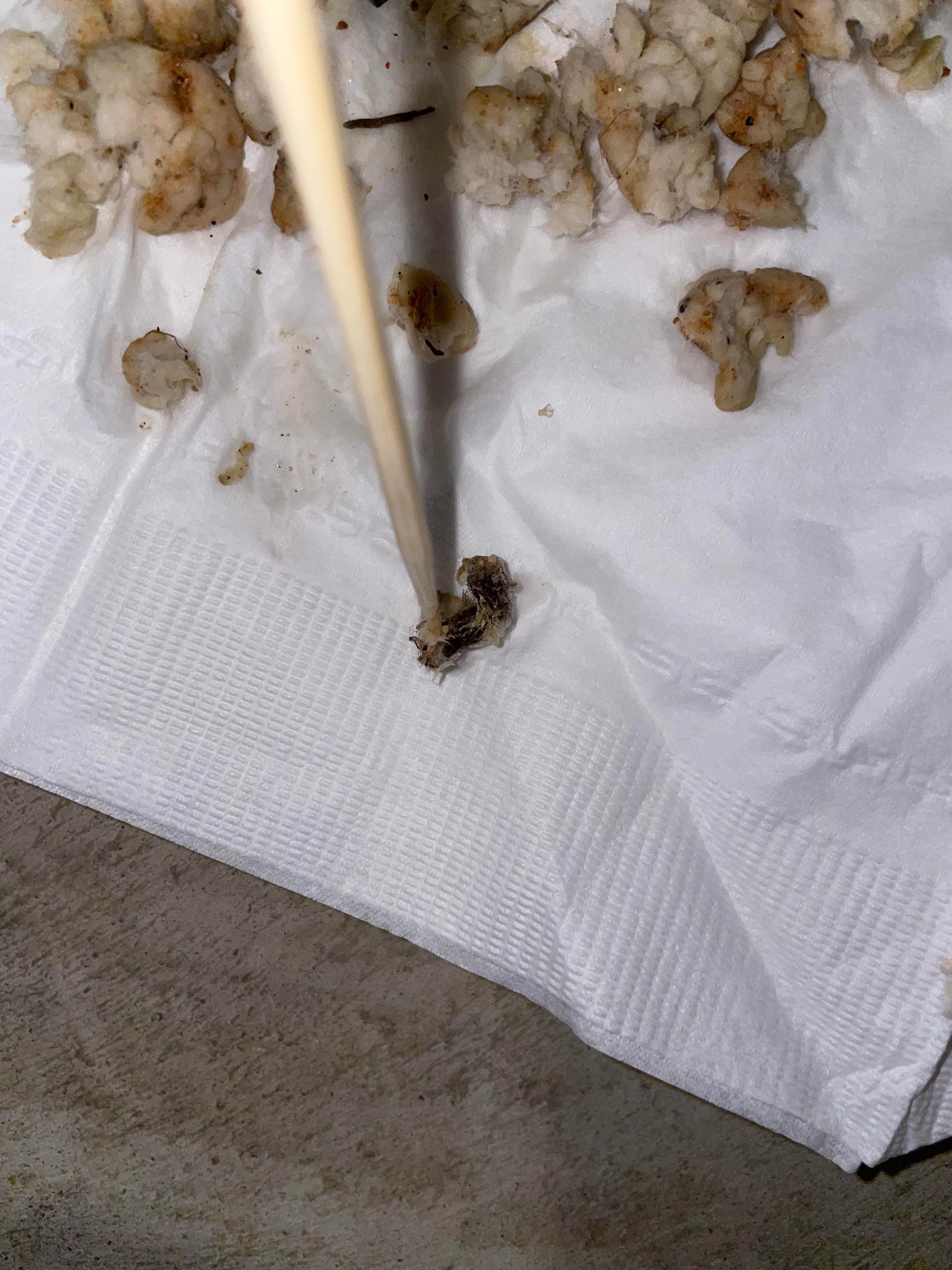 白色的大脑
