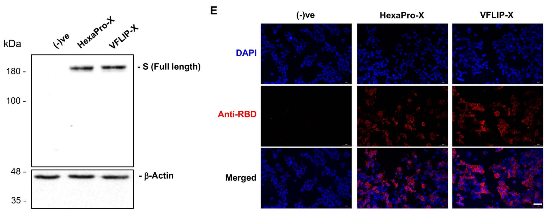 WB和免疫荧光证实编码2种Spike抗原的CircRNA在HEK293T细胞中可以正常表达。