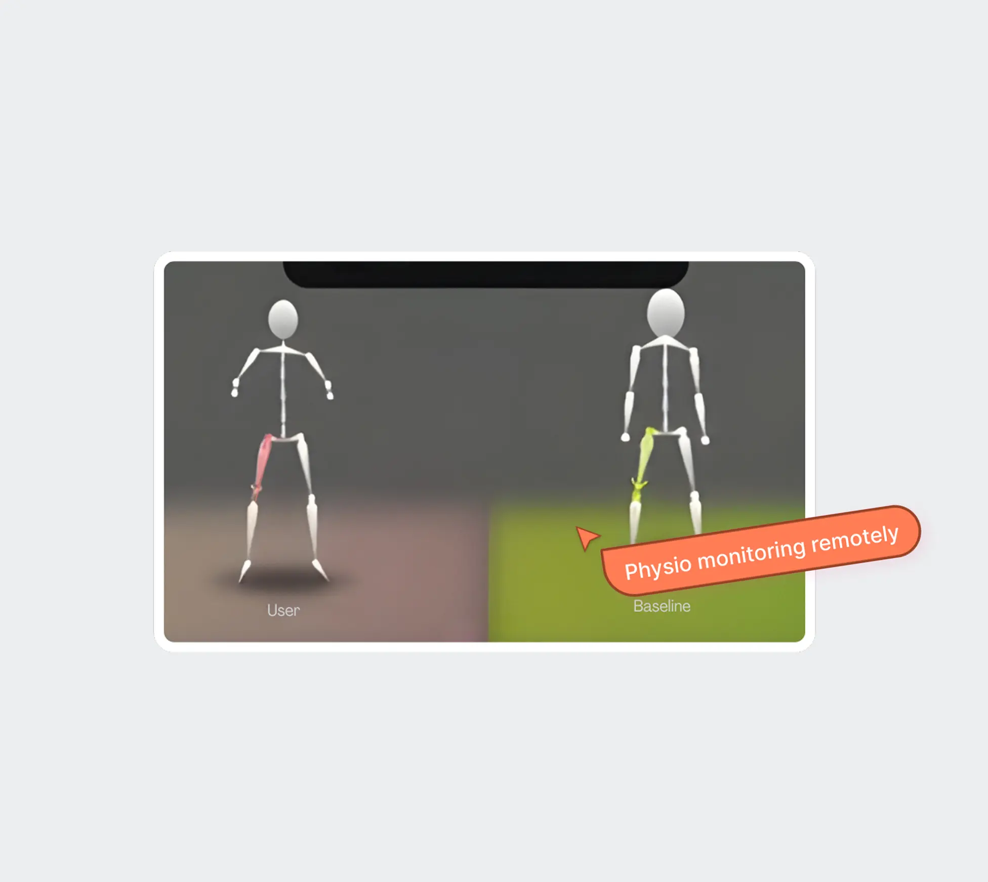 Remote monitoring preview