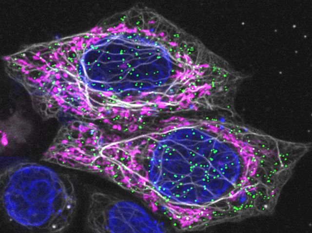 Fluoresce M'lady: A novel near infrared reversibly switchable fluorescent protein PENELOPE enhances super-res live-cell imaging