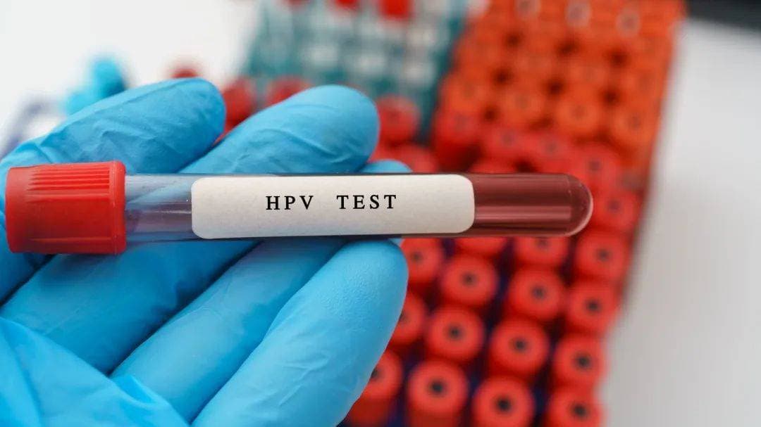 HPV test