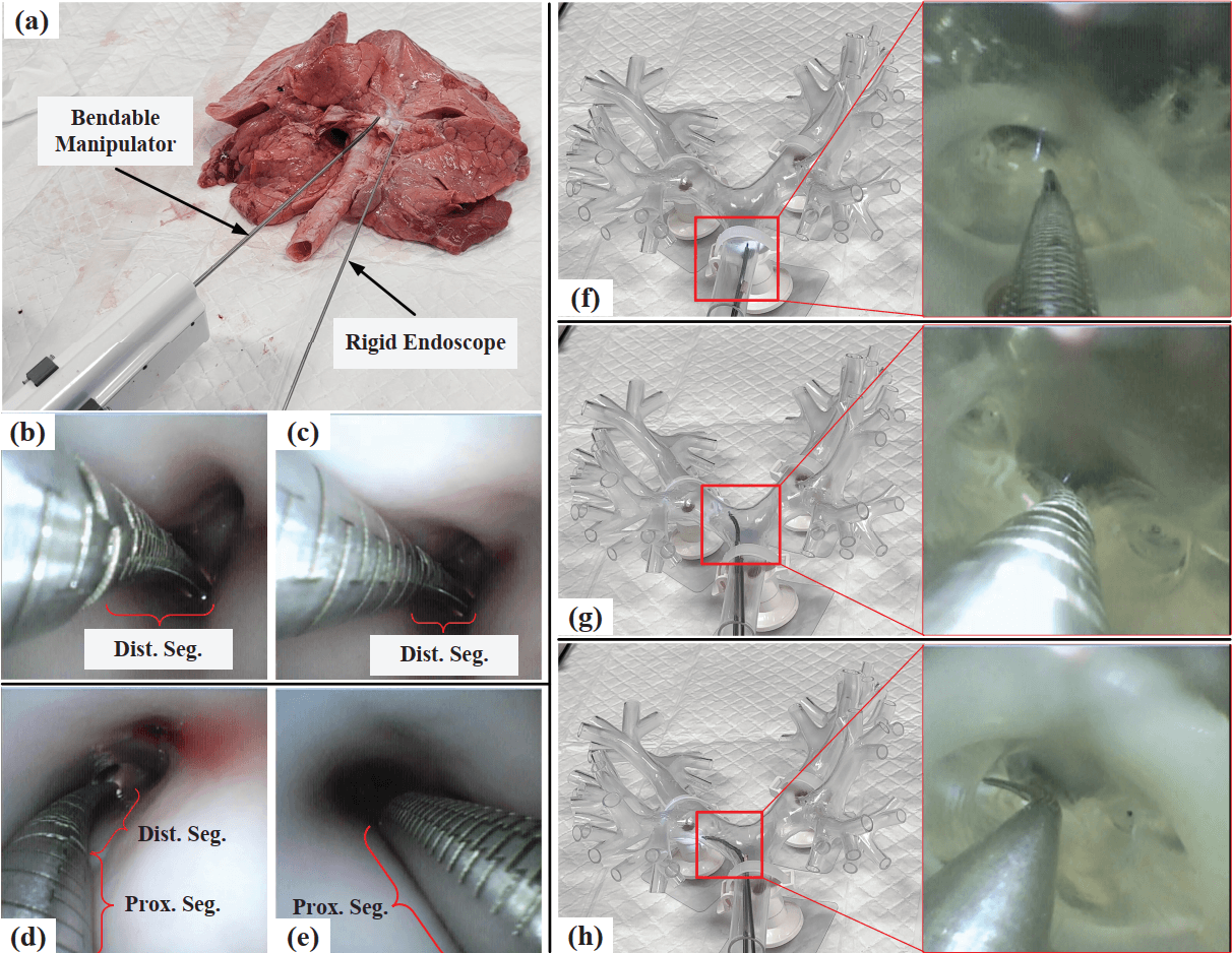Multifunction Robotized Surgical Dissector for Endoscopic Pulmonary Thromboendarterectomy: Preclinical Study and Evaluation