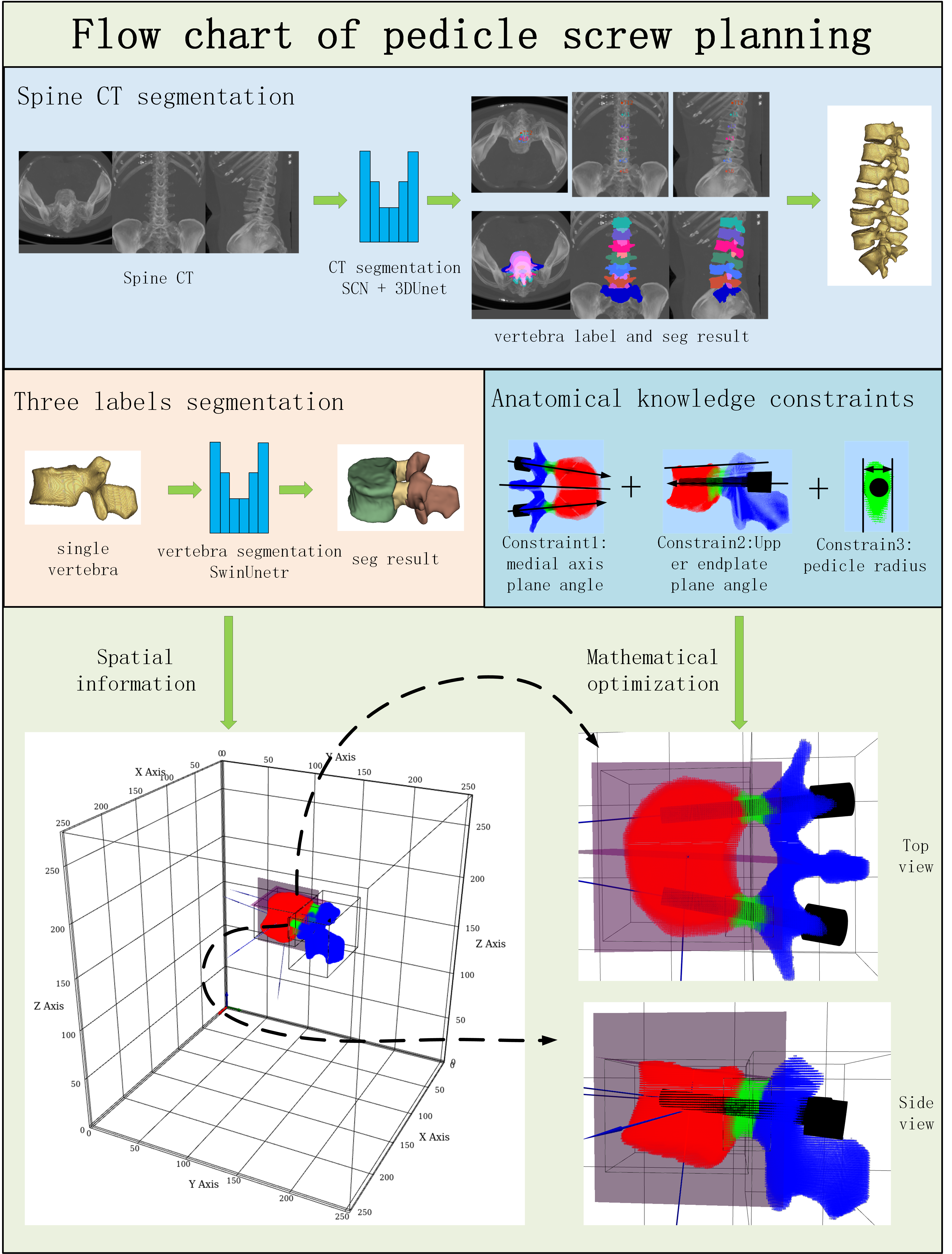 pedicle_screw_planning