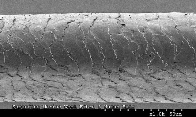发丝的角质层电镜图-图源来自网络