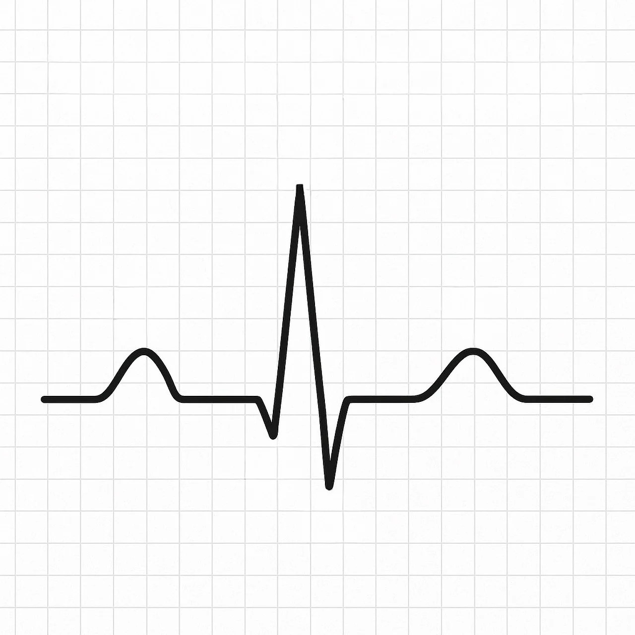 实战：心电图信号处理