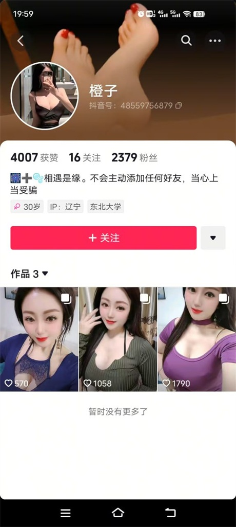 ❣️推荐❣️抖音颜值嫩妹【橙子】大尺度掰逼展示，道具自慰高潮，可惜是对人工奶5V