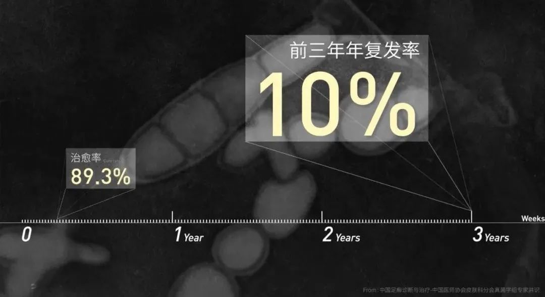 Vol/Vol.129 为什么你的脚这么臭/18.jpeg