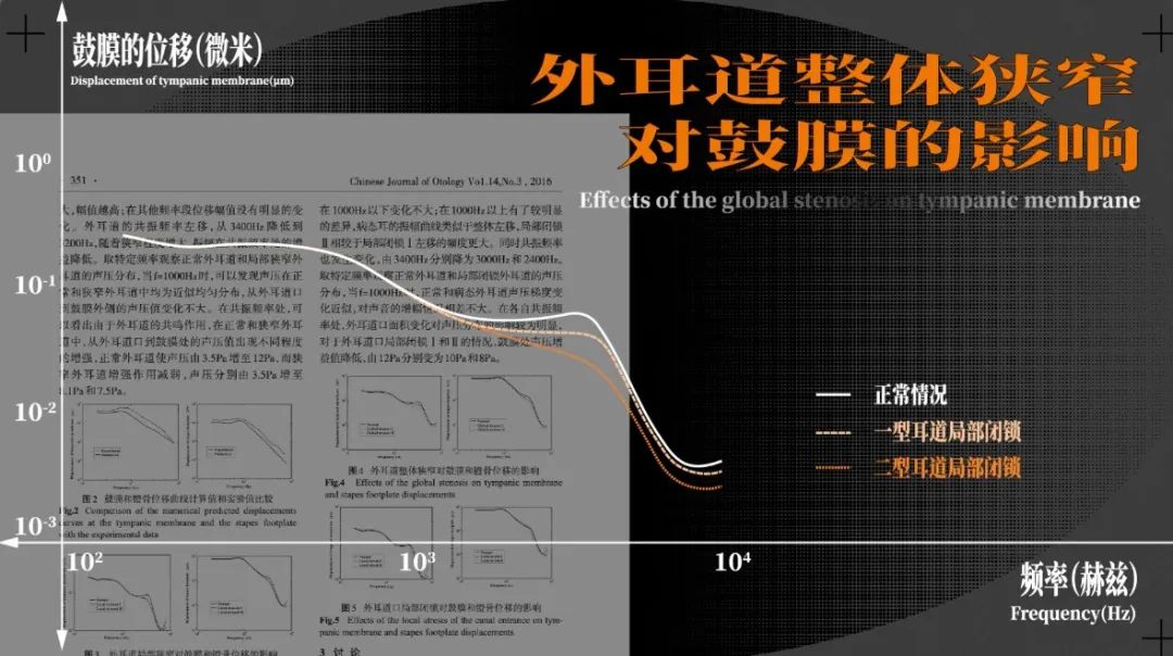 Ad/回形针事务所 028：戴耳机的你，听力为什么越来越差？/11.jpeg