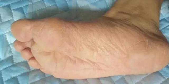 经常吃南瓜有什么好处？医生提醒：但这4类人群尽量别吃太多