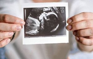 تغییرات هورمون‌های بارداری؛ احساسی که گاهی به کابوس تبدیل می‌شود