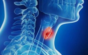 هشدار پژوهشگران؛ آلودگی محیطی، تیروئید کودکان را هدف گرفته است