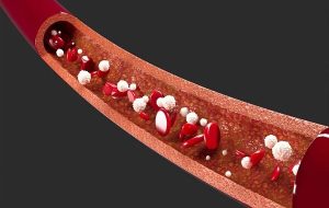 پایش لحظه‌ای غلظت دارو در خون با حسگر نانویی ممکن شد