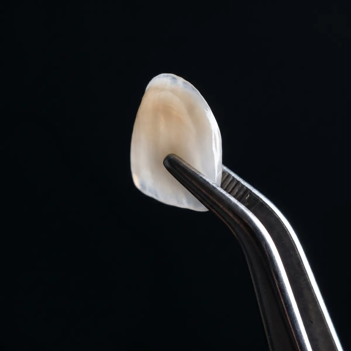 Perfekte Veneers