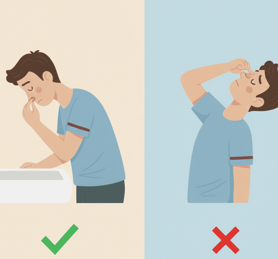 Inclinación hacia adelante