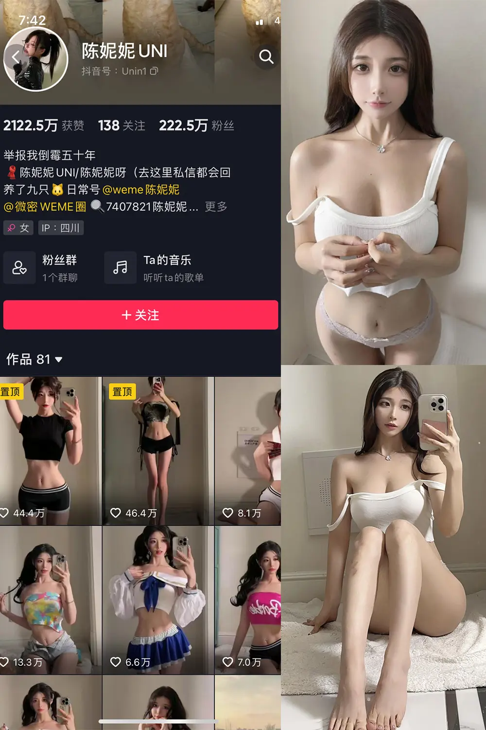 抖音陈妮妮UNI 微密圈NO.063期【24P1V】-密资库