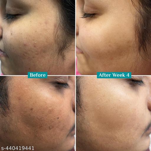 10% Vitamin C Face Serum (30 ml) - Triffystore 