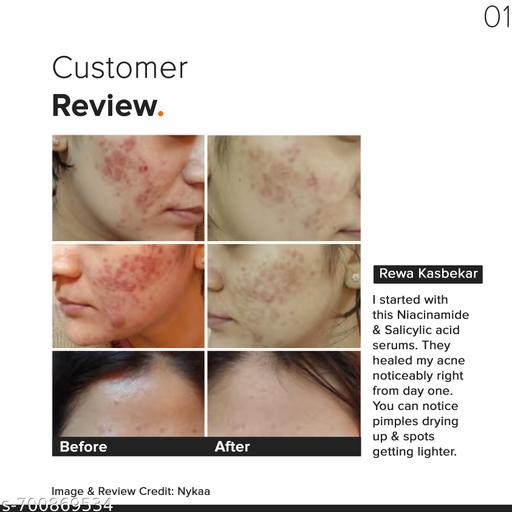 Salicylic Acid 02% Face Serum | BHA-Based Anti-Acne Exfoliant for Reducing Blackheads, Excess Oil & Bumpy Texture | 10ml - Lumae