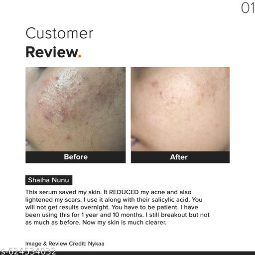 Niacinamide 10% + Zinc Face Serum | Sebum & Oil-Control Serum for Clarifying Skin & Blemishes | 10ml - Lumae