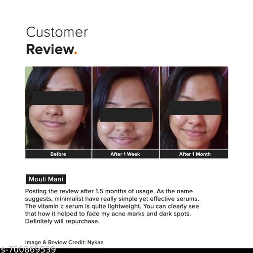 10% Vitamin C Face Serum | Skin Brightening Serum | 30ml - Lumae