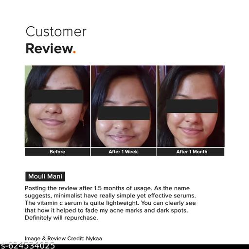 10% Vitamin C Face Serum | Skin Brightening Serum | 10ml - Lumae