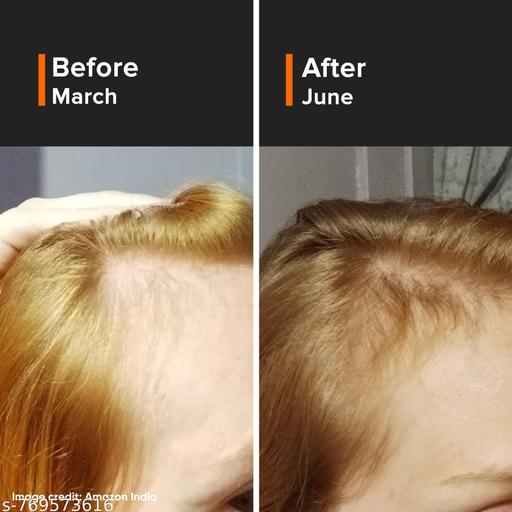 Hair Growth Actives 18% Hair Serum 30ml - Lumae