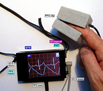 ECG With PPG Using Arduino