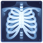 x-ray