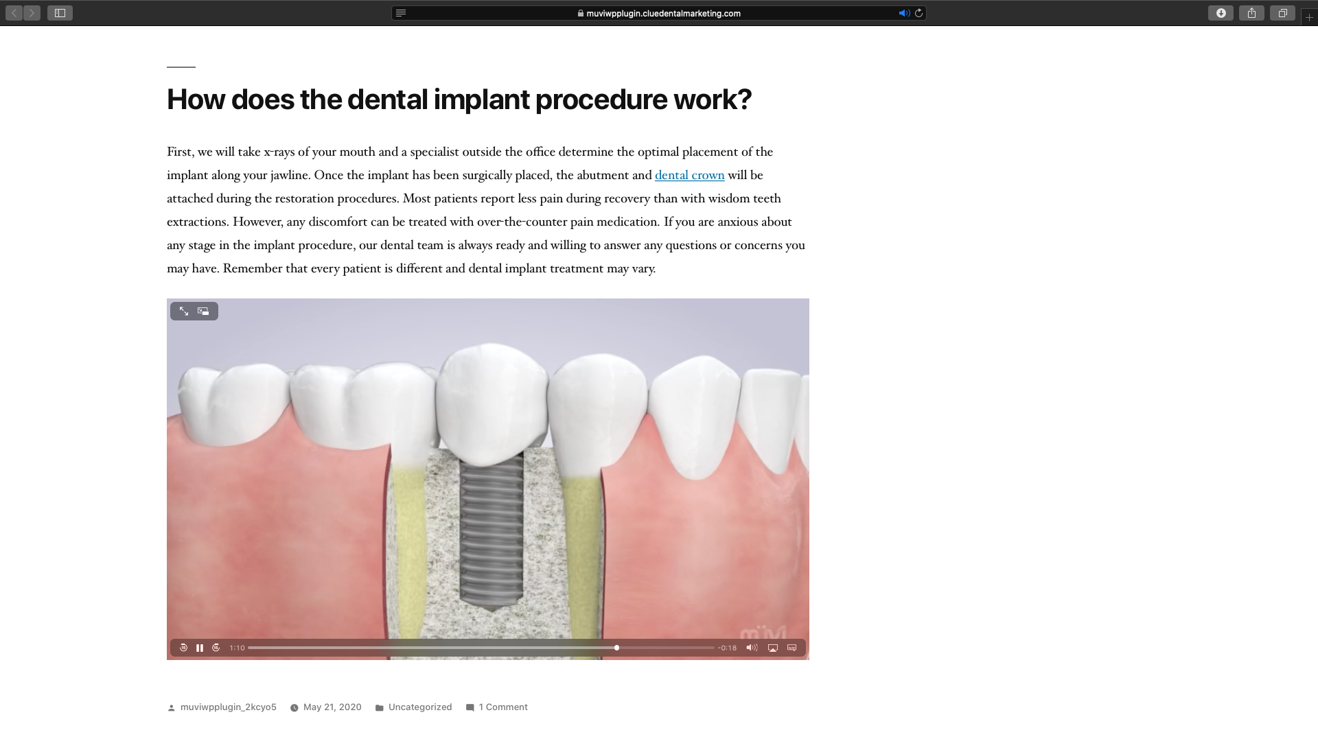 Easily add dental education videos to your posts and pages.