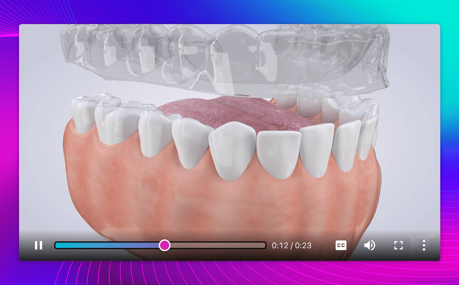 Beautiful, full-quality video playback your patients will love.