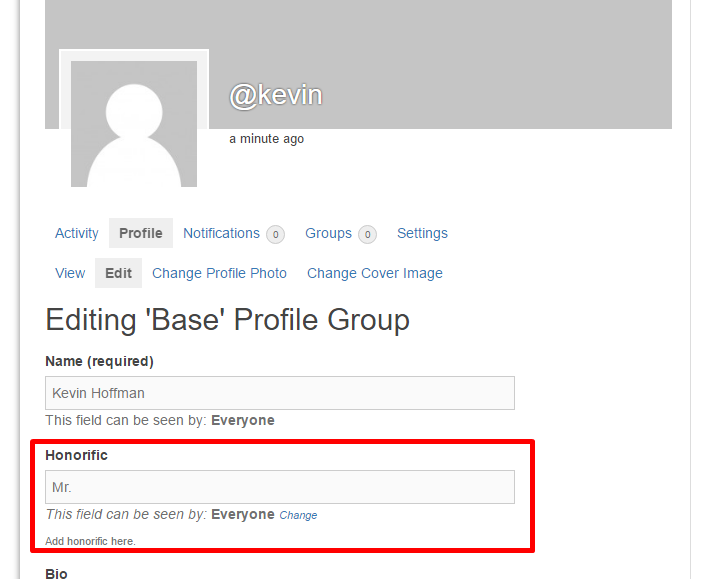 Users can add "Honorific" in their profile.
