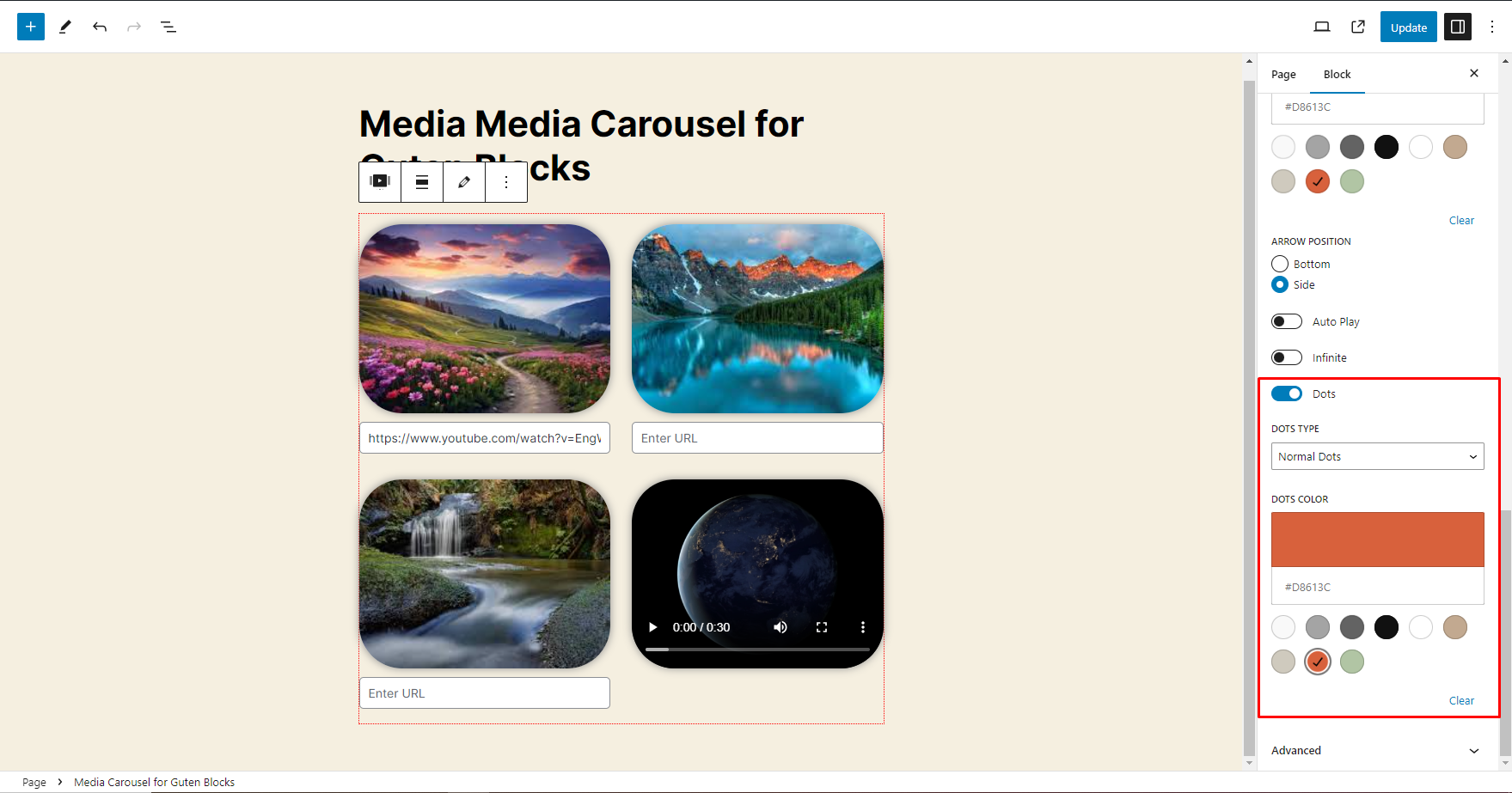 It will show Front-End View for Media Carousel when Caption is Enable ,Dots is Enable and Enable the Navigation Arrows option