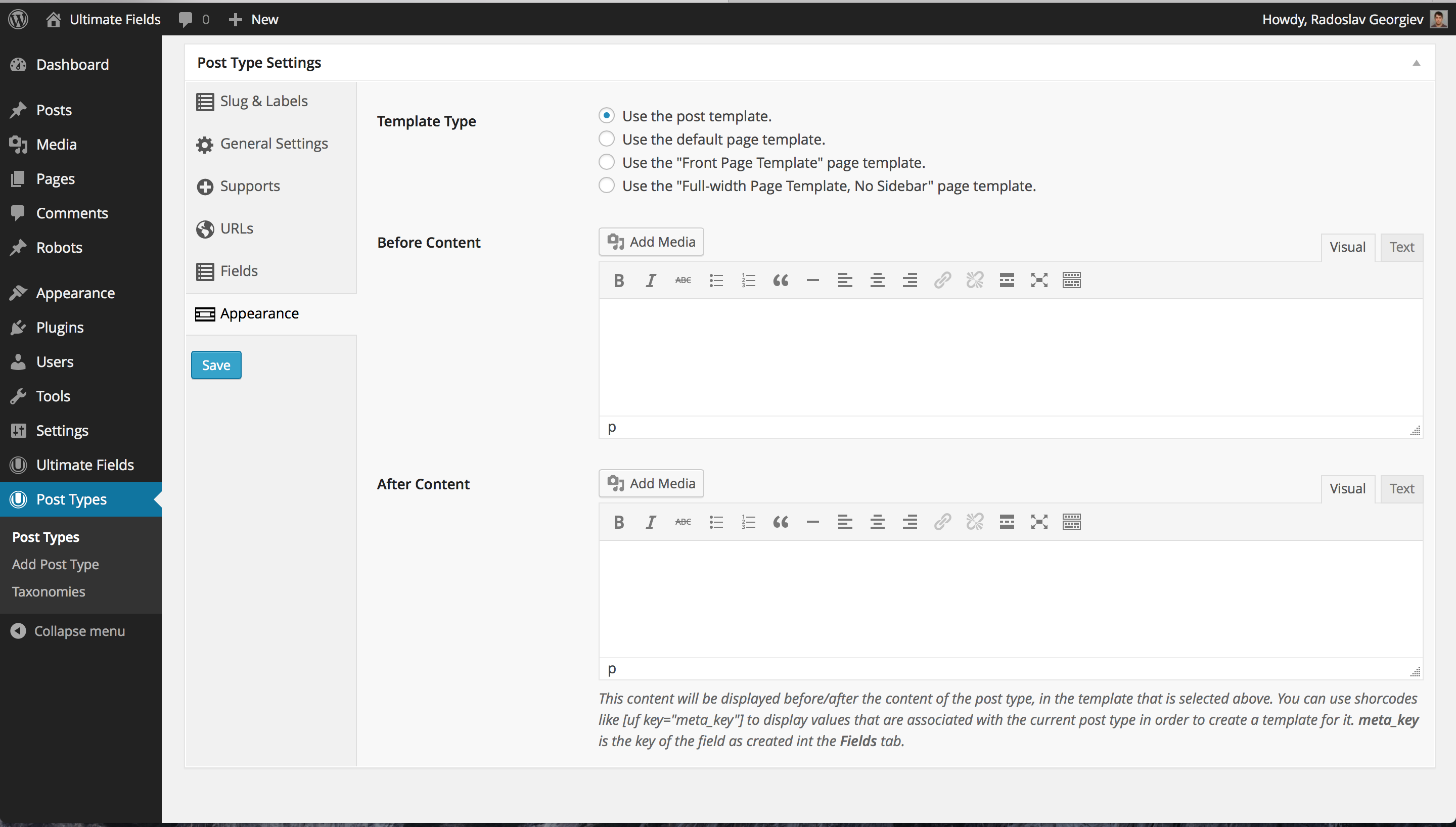 The third screenshot shows how you can modify the template of the post type.